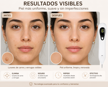 Pura™ Removedor Dermatológico de Precisión